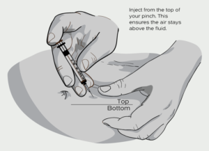 Where Do You Inject Peptides?
